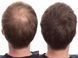 Загуститель для волос Toppik Hair Building Fibers Light brown toppik-Light brown фото 2