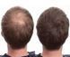 Загусник для волосся Toppik Hair Building Fibers medium brown А044 фото 4